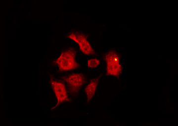 CHEK1 / CHK1 Antibody - Staining HeLa cells by IF/ICC. The samples were fixed with PFA and permeabilized in 0.1% Triton X-100, then blocked in 10% serum for 45 min at 25°C. The primary antibody was diluted at 1:200 and incubated with the sample for 1 hour at 37°C. An Alexa Fluor 594 conjugated goat anti-rabbit IgG (H+L) Ab, diluted at 1/600, was used as the secondary antibody.