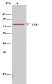 CHEK1 / CHK1 Antibody - CHK1 was immunoprecipitated using: Lane A: 0.5 mg Jurkat Whole Cell Lysate. 1 uL anti-CHK1 rabbit polyclonal antibody and 15 ul of 50% Protein G agarose. Primary antibody: Anti-CHK1 rabbit polyclonal antibody, at 1:500 dilution. Secondary antibody: Clean-Blot IP Detection Reagent (HRP) at 1:500 dilution. Developed using the DAB staining technique. Performed under reducing conditions. Predicted band size: 54 kDa. Observed band size: 54 kDa.