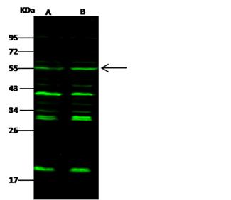 CHEK1 / CHK1 Antibody - Anti-CHK1 rabbit polyclonal antibody at 1:500 dilution. Lane A: K562 Whole Cell Lysate. Lane B: Jurkat Whole Cell Lysate. Lysates/proteins at 30 ug per lane. Secondary: Goat Anti-Rabbit IgG H&L (Dylight 800) at 1/10000 dilution. Developed using the Odyssey technique. Performed under reducing conditions. Predicted band size: 54 kDa. Observed band size: 55 kDa. (We are unsure as to the identity of these extra bands.)