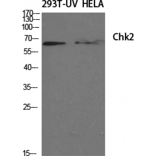 CHEK2 / CHK2 Antibody - Western blot of Chk2 antibody