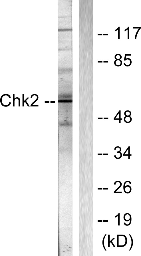 CHEK2 / CHK2 Antibody - Western blot analysis of lysates from Jurkat cells, using Chk2 Antibody. The lane on the right is blocked with the synthesized peptide.