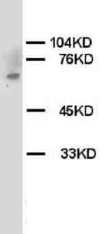 CHEK2 / CHK2 Antibody -  This image was taken for the unconjugated form of this product. Other forms have not been tested.
