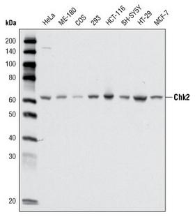 CHEK2 / CHK2 Antibody - Western blot using CHK2 mouse monoclonal antibody against cell lysate from various cell types.