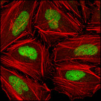 CHEK2 / CHK2 Antibody - Confocal immunofluorescence of HeLa cells using CHK2 mouse monoclonal antibody (green), showing nuclear localization. Red: Actin filaments have been labeled with DY-554 phalloidin.