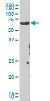 CHEK2 / CHK2 Antibody - CHEK2 monoclonal antibody (M04), clone 4F10 Western blot of CHEK2 expression in HeLa NE.