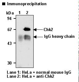 CHEK2 / CHK2 Antibody