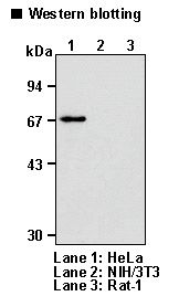 CHEK2 / CHK2 Antibody