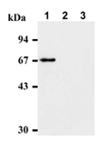 CHEK2 / CHK2 Antibody - Western blot of HeLa cells (1), NIH/3T3 cells (2) and Rat-1 cells (3) using Chk2 monoclonal antibody (DCS - 270)