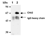 CHEK2 / CHK2 Antibody - Immunoprecipitation of Chk2 from HeLa cells with normal mouse IgG (1) or K0087 -3 (2). After immunoprecipitated with the antibody, immunocomplex was resolved on SDS -PAGE and immunoblotted with Chk2 mAb (DCS-270).