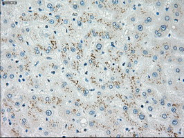 CHEK2 / CHK2 Antibody - IHC of paraffin-embedded liver tissue using anti-CHEK2 mouse monoclonal antibody. (Dilution 1:50).
