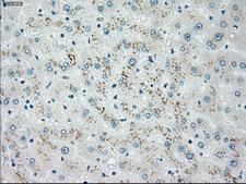 CHEK2 / CHK2 Antibody - IHC of paraffin-embedded liver tissue using anti-CHEK2 mouse monoclonal antibody. (Dilution 1:50).