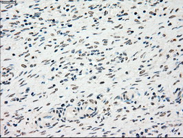 CHEK2 / CHK2 Antibody - IHC of paraffin-embedded Ovary tissue using anti-CHEK2 mouse monoclonal antibody. (Dilution 1:50).