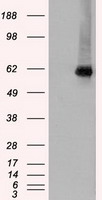 CHEK2 / CHK2 Antibody - HEK293T cells were transfected with the pCMV6-ENTRY control (Left lane) or pCMV6-ENTRY CHEK2 (Right lane) cDNA for 48 hrs and lysed. Equivalent amounts of cell lysates (5 ug per lane) were separated by SDS-PAGE and immunoblotted with anti-CHEK2.