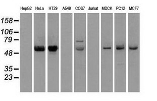 CHEK2 / CHK2 Antibody - Western blot analysis of extracts (35ug) from 9 different cell lines by using anti-CHEK2 monoclonal antibody.