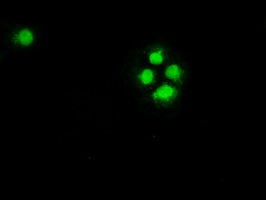 CHEK2 / CHK2 Antibody - Anti-CHEK2 mouse monoclonal antibody  immunofluorescent staining of COS7 cells transiently transfected by pCMV6-ENTRY CHEK2.