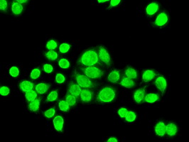 CHEK2 / CHK2 Antibody - Immunofluorescent staining of HT29 cells using anti-CHEK2 mouse monoclonal antibody.