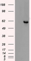 CHEK2 / CHK2 Antibody - HEK293T cells were transfected with the pCMV6-ENTRY control (Left lane) or pCMV6-ENTRY CHEK2 (Right lane) cDNA for 48 hrs and lysed. Equivalent amounts of cell lysates (5 ug per lane) were separated by SDS-PAGE and immunoblotted with anti-CHEK2.
