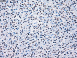 CHEK2 / CHK2 Antibody - IHC of paraffin-embedded pancreas tissue using anti-CHEK2 mouse monoclonal antibody. (Dilution 1:50).
