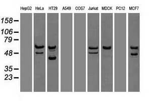 CHEK2 / CHK2 Antibody - Western blot of extracts (35 ug) from 9 different cell lines by using anti-CHEK2 monoclonal antibody.