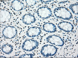 CHEK2 / CHK2 Antibody - IHC of paraffin-embedded colon tissue using anti-CHEK2 mouse monoclonal antibody. (Dilution 1:50).