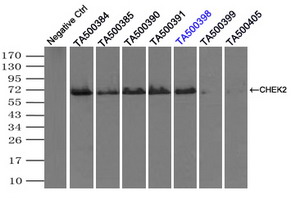 CHEK2 / CHK2 Antibody - Immunoprecipitation(IP) of CHEK2 by using monoclonal anti-CHEK2 antibodies (Negative control: IP without adding anti-CHEK2 antibody.). For each experiment, 500ul of DDK tagged CHEK2 overexpression lysates (at 1:5 dilution with HEK293T lysate), 2 ug of anti-CHEK2 antibody and 20ul (0.1 mg) of goat anti-mouse conjugated magnetic beads were mixed and incubated overnight. After extensive wash to remove any non-specific binding, the immuno-precipitated products were analyzed with rabbit anti-DDK polyclonal antibody.