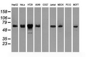 CHEK2 / CHK2 Antibody - Western blot of extracts (35 ug) from 9 different cell lines by using anti-CHEK2 monoclonal antibody.