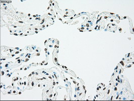 CHEK2 / CHK2 Antibody - IHC of paraffin-embedded lung tissue using anti-CHEK2 mouse monoclonal antibody. (Dilution 1:50).