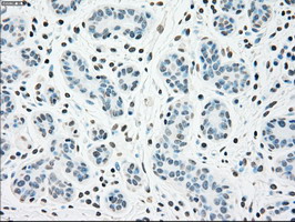 CHEK2 / CHK2 Antibody - IHC of paraffin-embedded breast tissue using anti-CHEK2 mouse monoclonal antibody. (Dilution 1:50).