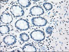 CHEK2 / CHK2 Antibody - IHC of paraffin-embedded colon tissue using anti-CHEK2 mouse monoclonal antibody. (Dilution 1:50).