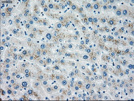 CHEK2 / CHK2 Antibody - IHC of paraffin-embedded liver tissue using anti-CHEK2 mouse monoclonal antibody. (Dilution 1:50).