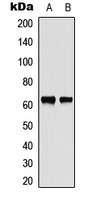 CHEK2 / CHK2 Antibody - Western blot analysis of CHK2 expression in MCF7 (A); Jurkat (B) whole cell lysates.