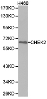 CHEK2 / CHK2 Antibody - Western blot of extracts of H460 cell lines, using CHEK2 antibody.