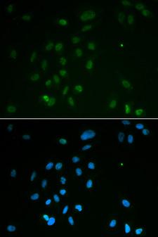 CHEK2 / CHK2 Antibody - Immunofluorescence analysis of MCF7 cells.