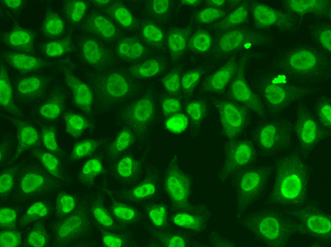 CHEK2 / CHK2 Antibody - Immunofluorescence analysis of A549 cells.