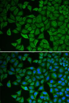 CHEK2 / CHK2 Antibody - Immunofluorescence analysis of HeLa cells using CHEK2 antibody. Blue: DAPI for nuclear staining.