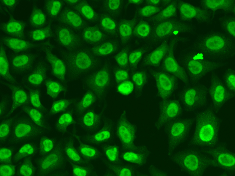 CHEK2 / CHK2 Antibody - Immunofluorescence analysis of A549 cells using CHEK2 antibody.