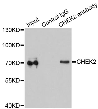 CHEK2 / CHK2 Antibody - Immunoprecipitation analysis of 200ug extracts of MCF-7 cells using 1ug CHEK2 antibody. Western blot was performed from the immunoprecipitate using CHEK2 antibody at a dilition of 1:1000.