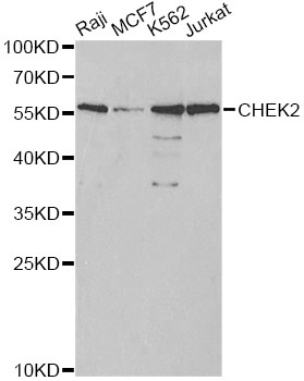 CHEK2 / CHK2 Antibody - Western blot analysis of extracts of various cell lines, using CHEK2 antibody at 1:1000 dilution. The secondary antibody used was an HRP Goat Anti-Rabbit IgG (H+L) at 1:10000 dilution. Lysates were loaded 25ug per lane and 3% nonfat dry milk in TBST was used for blocking.