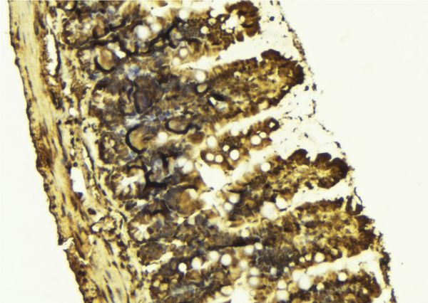 CHEK2 / CHK2 Antibody - 1:100 staining mouse colon tissue by IHC-P. The sample was formaldehyde fixed and a heat mediated antigen retrieval step in citrate buffer was performed. The sample was then blocked and incubated with the antibody for 1.5 hours at 22°C. An HRP conjugated goat anti-rabbit antibody was used as the secondary.