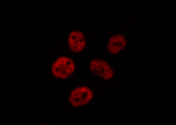 CHEK2 / CHK2 Antibody - Staining 293 cells by IF/ICC. The samples were fixed with PFA and permeabilized in 0.1% Triton X-100, then blocked in 10% serum for 45 min at 25°C. The primary antibody was diluted at 1:200 and incubated with the sample for 1 hour at 37°C. An Alexa Fluor 594 conjugated goat anti-rabbit IgG (H+L) Ab, diluted at 1/600, was used as the secondary antibody.