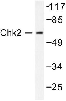CHEK2 / CHK2 Antibody - Western blot of Chk2 (M381) pAb in extracts from Jurkat cells.