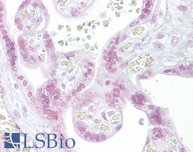 CHEK2 / CHK2 Antibody - Anti-CHEK2 / CHK2 antibody IHC of human placenta. Immunohistochemistry of formalin-fixed, paraffin-embedded tissue after heat-induced antigen retrieval. Antibody concentration 10 ug/ml.  This image was taken for the unconjugated form of this product. Other forms have not been tested.