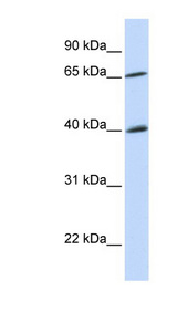 CHEK2 / CHK2 Antibody - CHEK2 / CHK2 antibody Western blot of Fetal Brain lysate. This image was taken for the unconjugated form of this product. Other forms have not been tested.