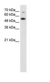 CHEK2 / CHK2 Antibody - Jurkat Cell Lysate.  This image was taken for the unconjugated form of this product. Other forms have not been tested.