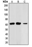 CHEK2 / CHK2 Antibody - Western blot analysis of CHK2 expression in Jurkat (A); HL60 (B); HT29 (C) whole cell lysates.