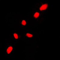CHEK2 / CHK2 Antibody - Immunofluorescent analysis of CHK2 staining in HL60 cells. Formalin-fixed cells were permeabilized with 0.1% Triton X-100 in TBS for 5-10 minutes and blocked with 3% BSA-PBS for 30 minutes at room temperature. Cells were probed with the primary antibody in 3% BSA-PBS and incubated overnight at 4 C in a humidified chamber. Cells were washed with PBST and incubated with a DyLight 594-conjugated secondary antibody (red) in PBS at room temperature in the dark. DAPI was used to stain the cell nuclei (blue).