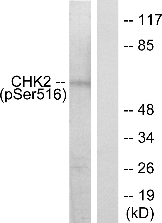 CHEK2 / CHK2 Antibody - Western blot analysis of lysates from HeLa cells treated with UV, using Chk2 (Phospho-Ser516) Antibody. The lane on the right is blocked with the phospho peptide.