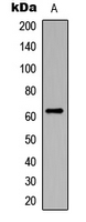 CHEK2 / CHK2 Antibody - Western blot analysis of CHK2 (pS516) expression in HeLa (A) whole cell lysates.