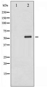 CHEK2 / CHK2 Antibody - Western blot of Chk2 phosphorylation expression in UV treated HeLa whole cell lysates,The lane on the left is treated with the antigen-specific peptide.