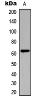 CHEK2 / CHK2 Antibody - Western blot analysis of CHK2 (pT383) expression in HeLa (A) whole cell lysates.